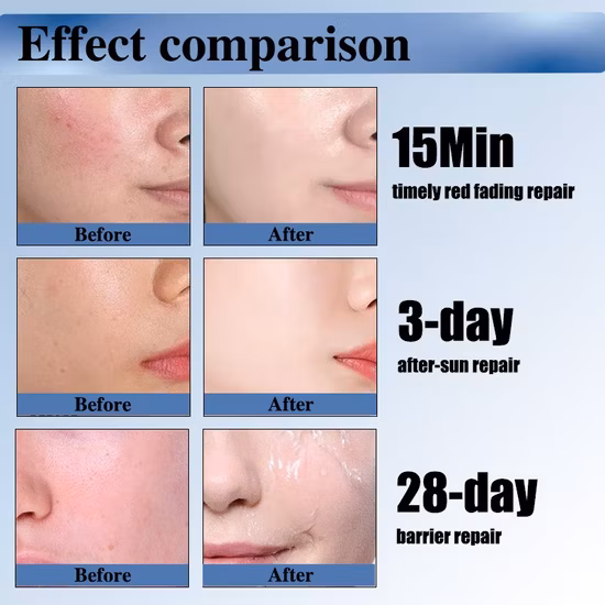 Factory Prices Korean Liquid 100unit Anti Wrinkles Type Nabot Innotx 150u Freeze Dried Powder Essence Smooth out Wrinkles
